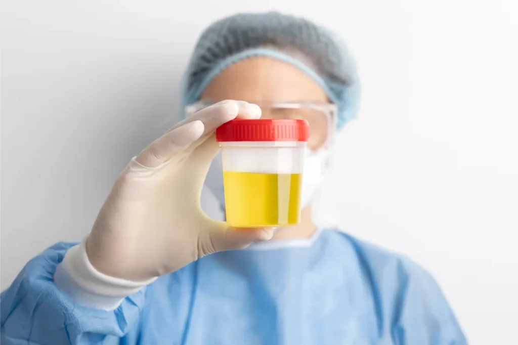 Urine Screening Services